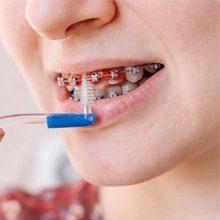 a patient with braces brushing her teeth